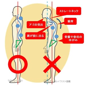 肩こりや背中痛の原因-1